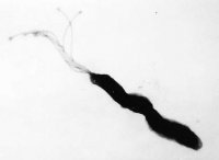 ピロリ菌の写真