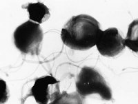 ピロリ菌の電子顕微鏡写真